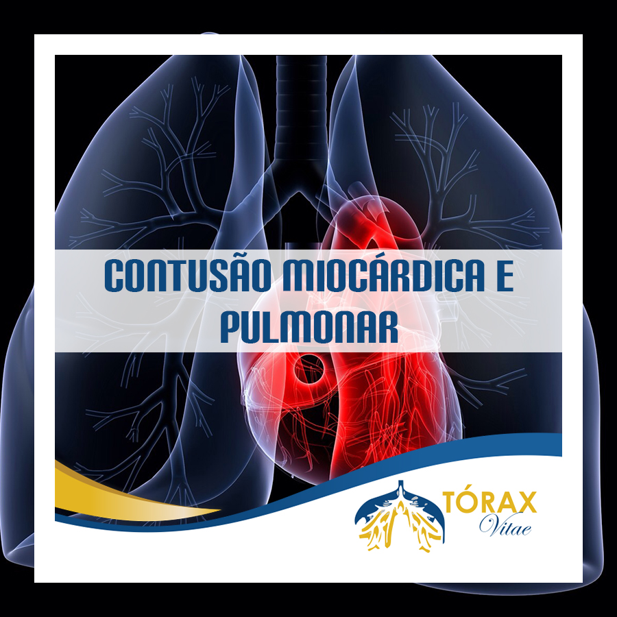 Contuso-Miocardica-Pulmonar1.jpg