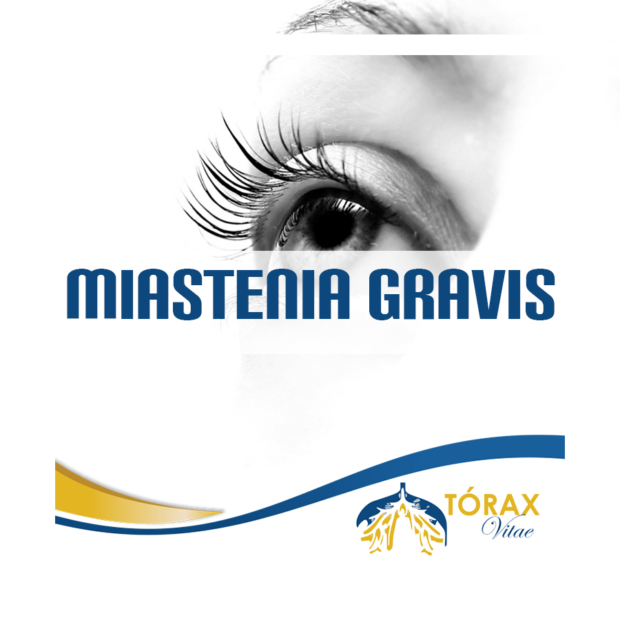 Miastenia-Gravis.jpg